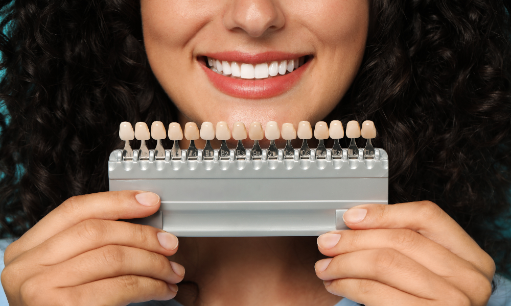 patient holding dental shade guide for veneers cost consultation Los Angeles CA