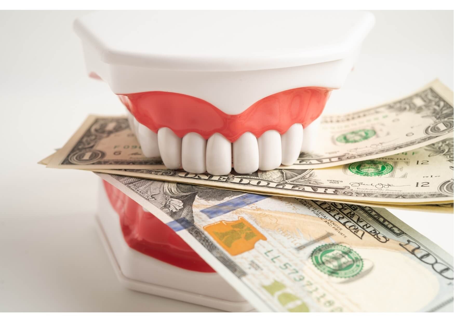 Full denture model placed on U.S. dollar bills representing the cost of dental implants and restorative dental treatment