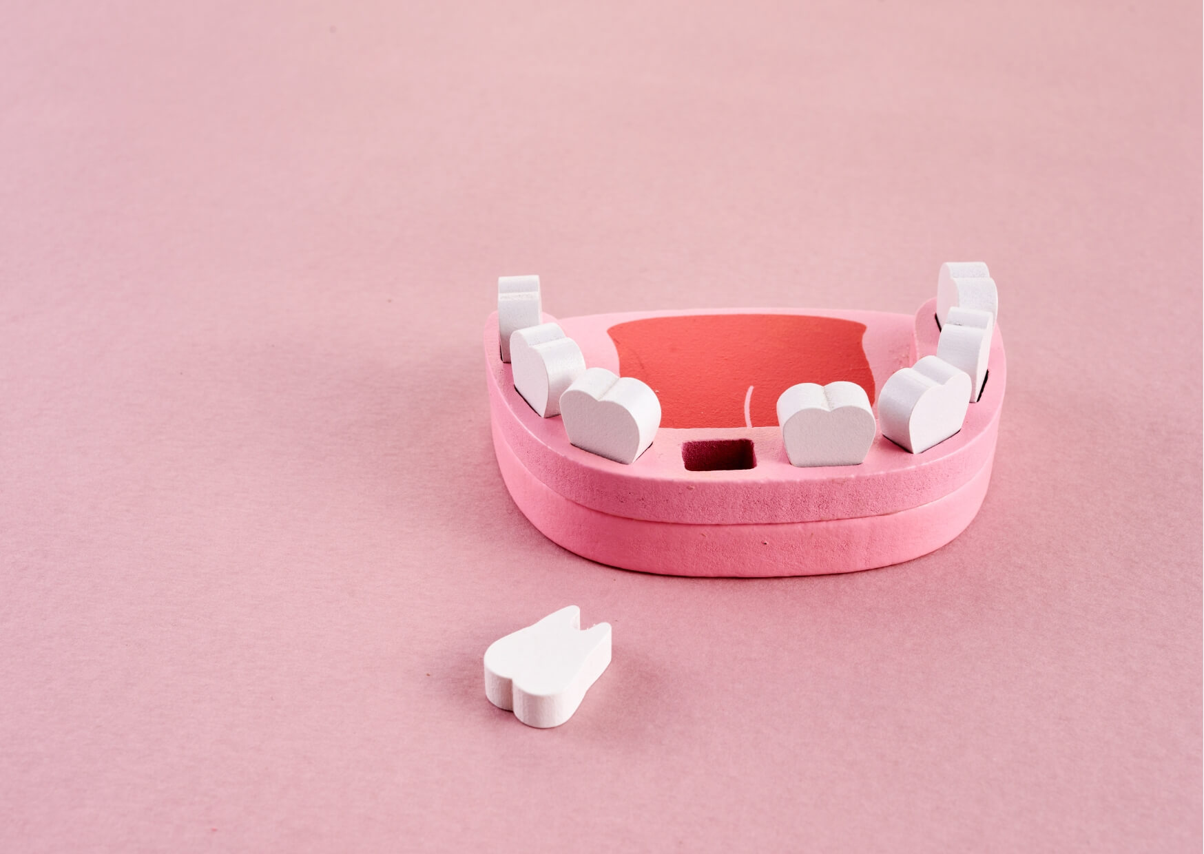 Dental model showing a missing tooth space, illustrating that adult teeth do not grow back once they are lost.